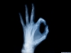 xray-38.jpg